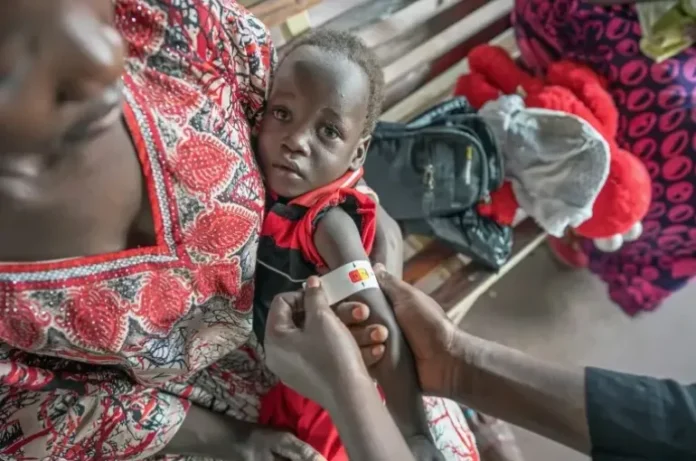 South Sudan A child is checked for malnutrition at the UNICEF-supported nutrition clinic at Kimu Primary Healthcare Centre in Juba, South Sudan. UNICEF/Naftalin