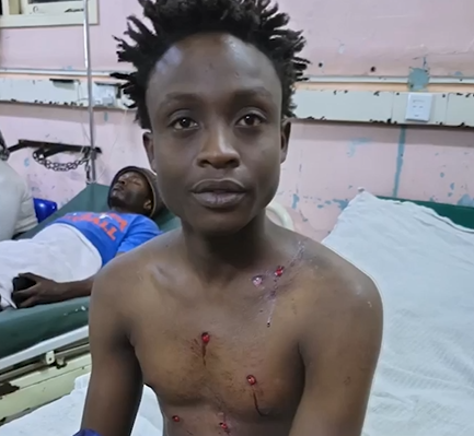 Boda Boda Rider Shot 7 Times During Ruiru Fuel Protests Speaks Out A boda boda rider shot seven times during the Ruiru fuel protests is demanding justice as concerns over police brutality intensify.